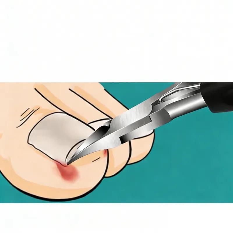 Toe Nail Clipper for Ingrown or Thick Toenails, Heavy Duty Toenail Trimmer Nail Clipper Pedicure Tool with Long Handle and Soft Grip for Seniors Red-3